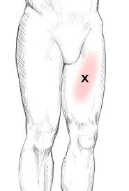 In a seated position turn your thigh inwards, pushing your hips forward, and pressing your knee to the ground. Sartorius Pain Trigger Points