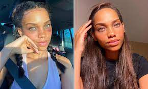 How important are these factors regarding your forehead reduction. Woman Who Hid Big Forehead Underneath A Fringe Has Spent Almost 7 000 On Reduction Surgery Daily Mail Online