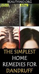 Dove deep conditioner for damaged hair is formulated to nourish and help restore hair from the inside out. Natural Hair Mask For Dandruff Dandruff Remedy Home Remedies For Dandruff Hair Mask For Dandruff