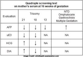 Image result for Quad Screen