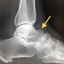 足首の痛み | 間庭整形外科