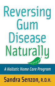 How to reverse gum disease fast. Reversing Gum Disease Naturally A Holistic Home Care Program Senzon Sandra 9780471222309 Amazon Com Books