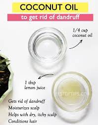 Coconut Oil To Get Rid Of Dandruff Scalp Moisturizer Getting Rid Of Dandruff Dandruff Remedy Coconut Oil