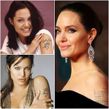 The success of your colorado springs laser tattoo removal treatment will often depend on the type of technology that is used. Can You Get A Tattoo Replacement After Laser Tattoo Removal