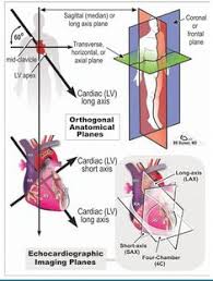 Pin By Andres Sanchez On Echocardiography Medical Anatomical Bulwer