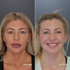 Lucas Bryant, MD added a new photo.