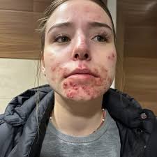 Here are the consequences of sleeping with… See more