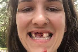 Fundraiser for Ellie Vates by James Granger : Help Ellie Get Her Smile Back