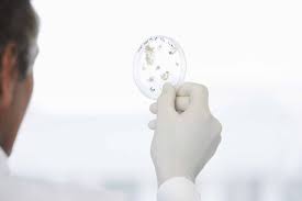 Quantitative bestimmung mittels immunoassay, gilt für die gebührenordnungspositionen 32365 bis 32381,. So Geht S Darmflora Stuhltest Fur Zuhause Florastatus Medavital Erfahrungen Studien