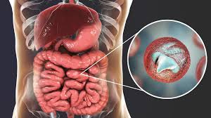 Parasiten, deren parasitismus gewöhnlich zum tode führt, werden als parasitoide oder raubparasiten bezeichnet, beispielsweise schlupfwespen. Parasiten Im Darm Verstehen Erkennen Loswerden