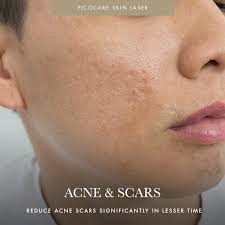 Try not to put too much pressure on. What Is Dead Skin Cells On Face Know It Info