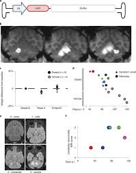 Image result for Black 1995 AAV