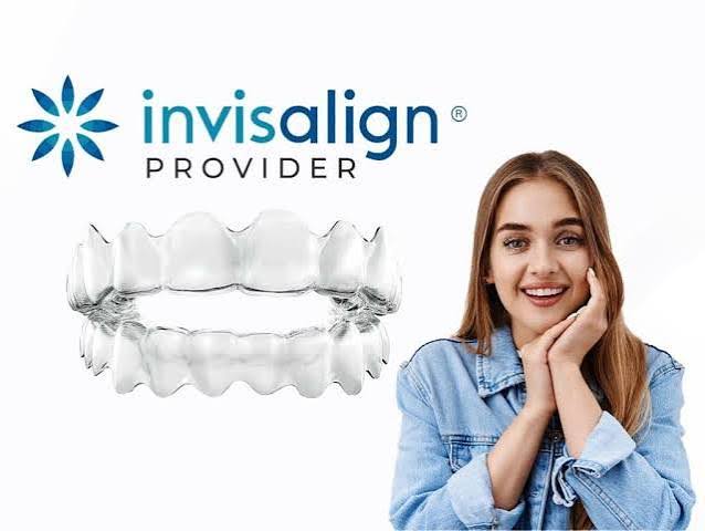 Invisalign Aligners