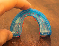 Whether you have braces and your dentist recommended you wear a night guard (or you notice some bruxism symptoms like morning headaches or a sore jaw muscles), you might wonder what it's like to wear a night guard with braces. Sports Mouth Guard Reviews And Faq The Healthy Mouth Project