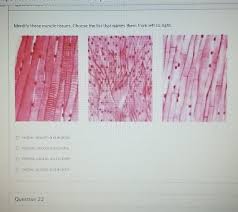 Www.metv.coolmy channel is about learning english. Solved Identify These Muscle Tissues Choose The List Tha Chegg Com