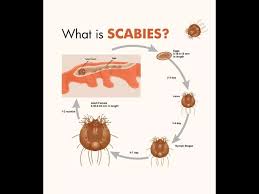 Image result for Sarcoptes scabiei life cycle
