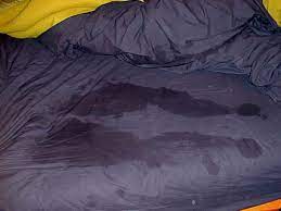 التعرق الليلي أثناء النوم