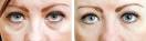 6 Ways to Get Perfect Eyebrows