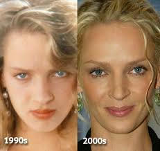 Twitter blew up with comments about how it looked like she'd had plastic surgery and how she looked well, a little different. Uma Thurman Nose