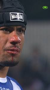 "The Bulldogs captain has made an official complaint. The accusation is  that Kyle Flanagan has bitten him."