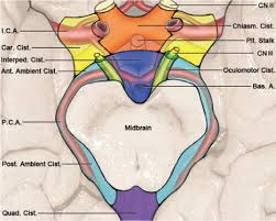Reinvestigation Of The Ambient Cistern And Its Related Arachnoid Membranes An Anatomical Study In Journal Of Neurosurgery Volume 115 Issue 1 2011