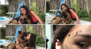 Porno padre costretto la figlia a scopare. Posa Per Una Foto Con Il Suo Cane Il Pastore Tedesco Le Azzanna Il Volto 40 Punti Di Sutura Immagini Choc