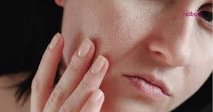 Jdi boleh memegang krim itu. Doktor Ini Kongsi Cara Rawat Kulit Kering Mengelupas Salah Satunya Mesti Pakai Sunscreen Pelembap Hijabista