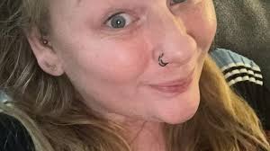 Devon woman diagnosed with incurable condition at 33