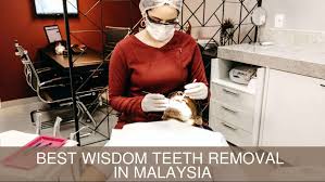 We offer several payment options to keep the cost of tooth extractions affordable. 10 Clinics For The Best Wisdom Teeth Removal In Malaysia 2021