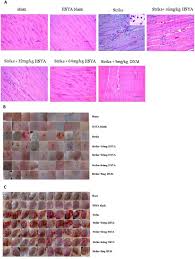Soft tissue injury victims typically face medical bills and lost income, in addition to their pain and when your soft tissue injury is the result of someone else's carelessness or recklessness, you new york city bar association. Hydroxysafflor Yellow A Attenuates The Expression Of Inflammatory Cytokines In Acute Soft Tissue Injury Scientific Reports