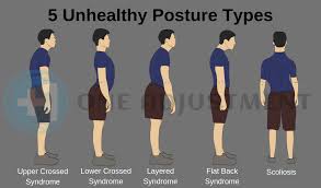 9 Exercises For Upper Crossed Posture One Adjustment