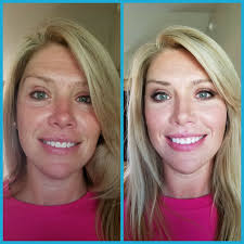 Beautiful Work by Gal Melinda.