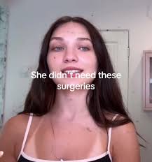 Did Mackenzie Ziegler Get Surgery
