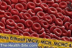 Anemie macrocitara, anemie megaloblastica, deficit de vitamina b12 /acid folic, consum cronic de etanol, afectiuni hepatice cronice. Mch Mcv Mchc Rdw Ceea Ce InseamnÄ Nivelurile Sanguine ÈtiinÈifico Practic Medical Journal 2021