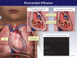 Image result for Pericardium