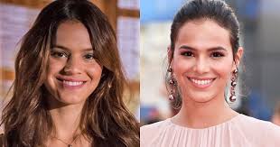 Últimas notícias de salvador, bahia, brasil e do mundo do jornal a tarde. Veja Antes E Depois De 15 Famosas Que Admitiram Rinoplastia E Fizeram Plastica No Nariz Fotos Purepeople