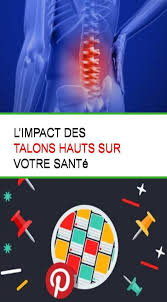 L Impact Des Talons Hauts Sur Votre Sante Sante Attention
