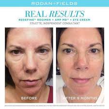 Banking collagen for younger looking skin