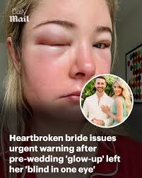 My left eye swelled completely shut. I wasn't crying