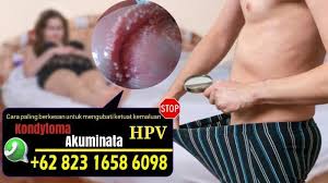 Mandi dengan air garam menggunakan air garam untuk mandi juga bisa meredakan gatal di kemaluan. Senerai Cara Hilangkan Ketuat Pada Kemaluan Tanpa Pembedahan Ubat Ketuat Di Farma Ubat Ketuat Herba Ubat Ketuat Faraj Ubat Ketuat Zakar Ubat Ketuat Kelamin