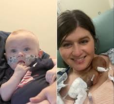 Iowa baby born 19 weeks early has set a world record:  https://www.wgem.com/2025/07/23/baby-born-133-days-early-has-set-world-record/