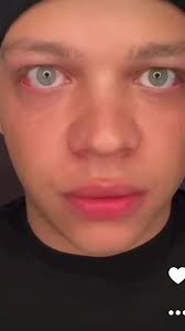 Who is the Real Spice King? Exploring Cameron Walker vs. Craven Capsicum