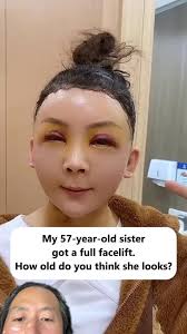 What are we doing to faces? 😢 #plasticsurgeon #facelift #doctorreacts
