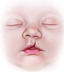 Thieme: Comprehensive Cleft Care