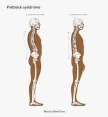 Image result for Low Back Standing Exam