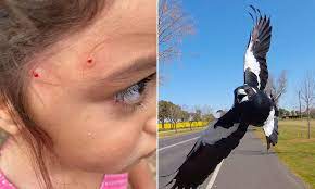 Check spelling or type a new query. Mum Issues Warning After Her Four Year Old Daughter Was Attacked By A Very Aggressive Magpie Daily Mail Online