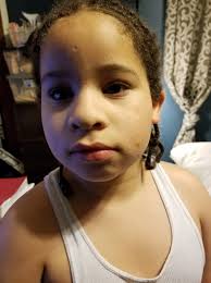 Ambassador recovering well after minor stroke