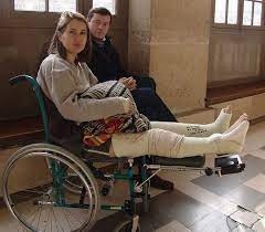 llc leg cast long leg cast it cast