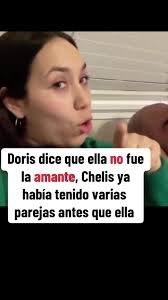 Doris Prieto Antes Y Después