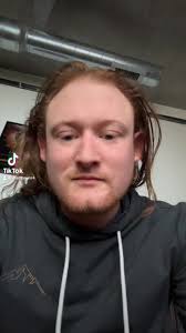 $87k per leg, 50 years of having prosthetic, 3 year life